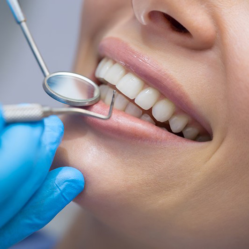 Dental examination and general dentistry
